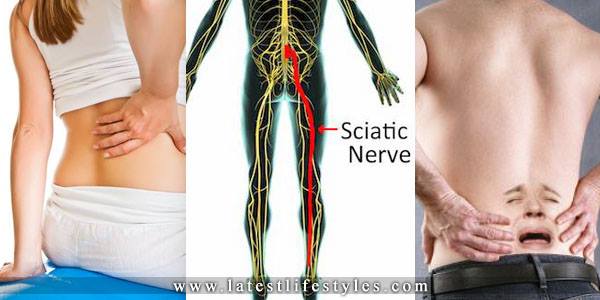 Sciatic Nerve Pain Effective Treatment